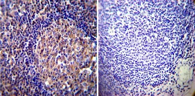Anti-Vimentin antibody [J144] used in IHC (Paraffin sections) (IHC-P). GTX80814