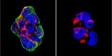 Anti-Vimentin antibody [J144] used in Immunocytochemistry/ Immunofluorescence (ICC/IF). GTX80814
