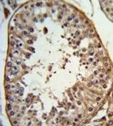 Anti-ANGEL1 antibody, C-term used in IHC (Paraffin sections) (IHC-P). GTX80925