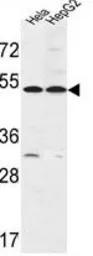 Anti-FERMT1 antibody, Internal used in Western Blot (WB). GTX80946