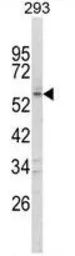 Anti-FOXC1 antibody, C-term used in Western Blot (WB). GTX80948