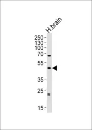 Anti-ABHD12 antibody, N-term used in Western Blot (WB). GTX80950