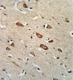 Anti-TCERG1L antibody, Internal used in IHC (Paraffin sections) (IHC-P). GTX80965