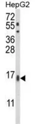 Anti-MGST2 antibody, C-term used in Western Blot (WB). GTX80967