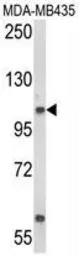 Anti-CASD1 antibody, N-term used in Western Blot (WB). GTX80980