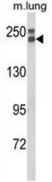 Anti-COL18A1 antibody, N-term used in Western Blot (WB). GTX80984
