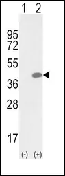 Anti-OLR1 / LOX-1 antibody, Internal used in Western Blot (WB). GTX80987