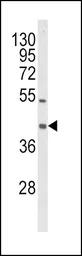 Anti-OLR1 / LOX-1 antibody, Internal used in Western Blot (WB). GTX80987