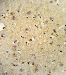 Anti-OLR1 / LOX-1 antibody, Internal used in IHC (Paraffin sections) (IHC-P). GTX80987