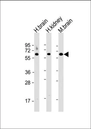Anti-Glutaminase antibody, C-term used in Western Blot (WB). GTX81012