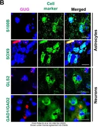 Anti-Glutaminase antibody, C-term used in  (). GTX81012