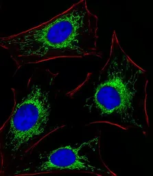 Anti-Glutaminase antibody, C-term used in Immunocytochemistry/ Immunofluorescence (ICC/IF). GTX81012