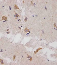 Anti-Glutaminase antibody, C-term used in IHC (Paraffin sections) (IHC-P). GTX81012