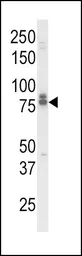 Anti-IL18 Receptor beta antibody, N-term used in Western Blot (WB). GTX81019