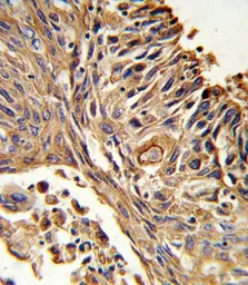 Anti-IL18 Receptor beta antibody, N-term used in IHC (Paraffin sections) (IHC-P). GTX81019