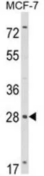 Anti-RASL11B antibody, N-term used in Western Blot (WB). GTX81024