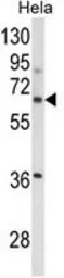Anti-ITGBL1 antibody, Internal used in Western Blot (WB). GTX81030