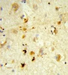 Anti-ITGBL1 antibody, Internal used in IHC (Paraffin sections) (IHC-P). GTX81030