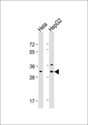 Anti-CTHRC1 antibody, N-term used in Western Blot (WB). GTX81033