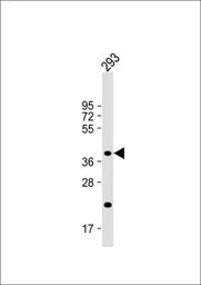 Anti-CSGALNACT2 antibody, Internal used in Western Blot (WB). GTX81034