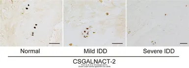 Anti-CSGALNACT2 antibody, Internal used in Immunohistochemistry (IHC). GTX81034