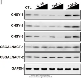 Anti-CSGALNACT2 antibody, Internal used in Western Blot (WB). GTX81034