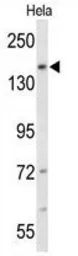 Anti-FNDC3B antibody, N-term used in Western Blot (WB). GTX81041