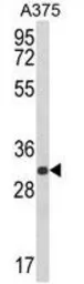 Anti-DERA antibody, N-term used in Western Blot (WB). GTX81043