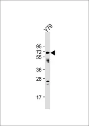Anti-NEURL antibody, Internal used in Western Blot (WB). GTX81057