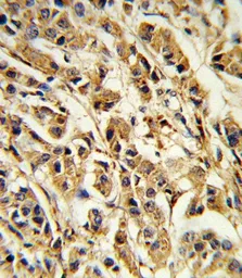 Anti-SREBP1 antibody, Internal used in IHC (Paraffin sections) (IHC-P). GTX81061