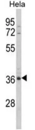 Anti-MDFIC antibody, N-term used in Western Blot (WB). GTX81076