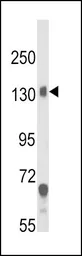 Anti-CACNA2D1 antibody, N-term used in Western Blot (WB). GTX81084