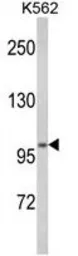 Anti-ATP12A antibody, Internal used in Western Blot (WB). GTX81091