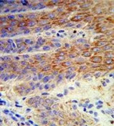 Anti-ATP12A antibody, Internal used in IHC (Paraffin sections) (IHC-P). GTX81091