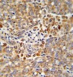 Anti-ALKBH3 antibody, C-term used in IHC (Paraffin sections) (IHC-P). GTX81095