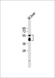 Anti-KMO antibody, Internal used in Western Blot (WB). GTX81111