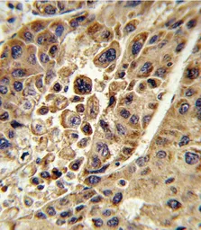 Anti-KMO antibody, Internal used in IHC (Paraffin sections) (IHC-P). GTX81111