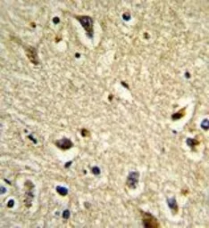 Anti-CYP2E1 antibody, C-term used in IHC (Paraffin sections) (IHC-P). GTX81120