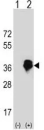 Anti-MLX antibody, Internal used in Western Blot (WB). GTX81125