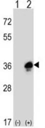 Anti-MPZ antibody, C-term used in Western Blot (WB). GTX81135
