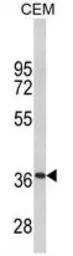Anti-MPZ antibody, C-term used in Western Blot (WB). GTX81135