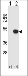 Anti-HLA-B antibody, N-term used in Western Blot (WB). GTX81138