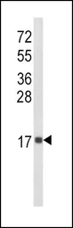 Anti-CXCL8 / IL8 antibody, C-term used in Western Blot (WB). GTX81140