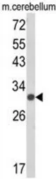 Anti-USF2 antibody, Internal used in Western Blot (WB). GTX81158
