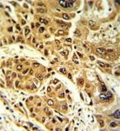Anti-Lipin 2 antibody, Internal used in IHC (Paraffin sections) (IHC-P). GTX81160