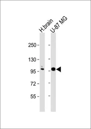 Anti-ANO5 antibody, C-term used in Western Blot (WB). GTX81161