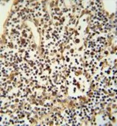Anti-ANO5 antibody, C-term used in IHC (Paraffin sections) (IHC-P). GTX81161