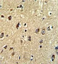 Anti-MRP5 antibody, Internal used in IHC (Paraffin sections) (IHC-P). GTX81163