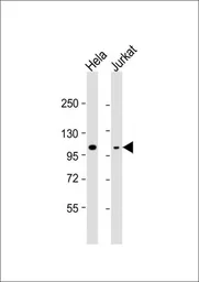 Anti-Rb antibody, C-term used in Western Blot (WB). GTX81164