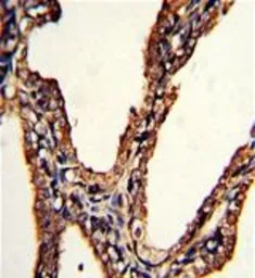 Anti-LMP2 antibody, C-term used in IHC (Paraffin sections) (IHC-P). GTX81175